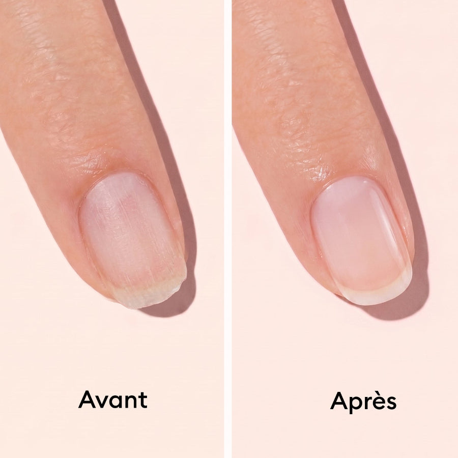 Coffret vernis soin pour ongles - Duo Day & Night - Avant/après